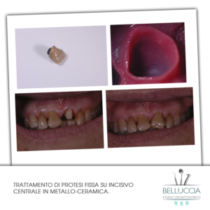 Belluccia Studio Odontoiatrico